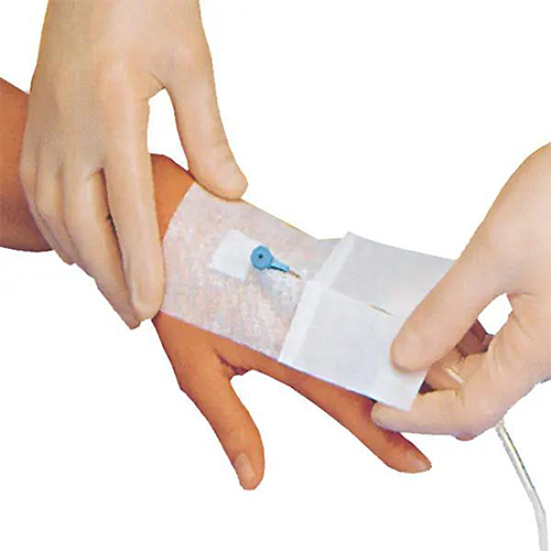 Eine Vielstoffkanülenfixierung die and der Hand eines Patienten abgezogen wird um dein Liegenden Vehenkatheter mit Schlauch befestigt zu halten.png